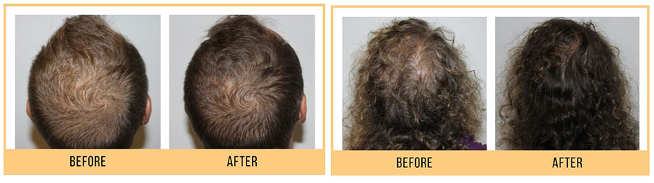 Chicago Hair treatment before and afters