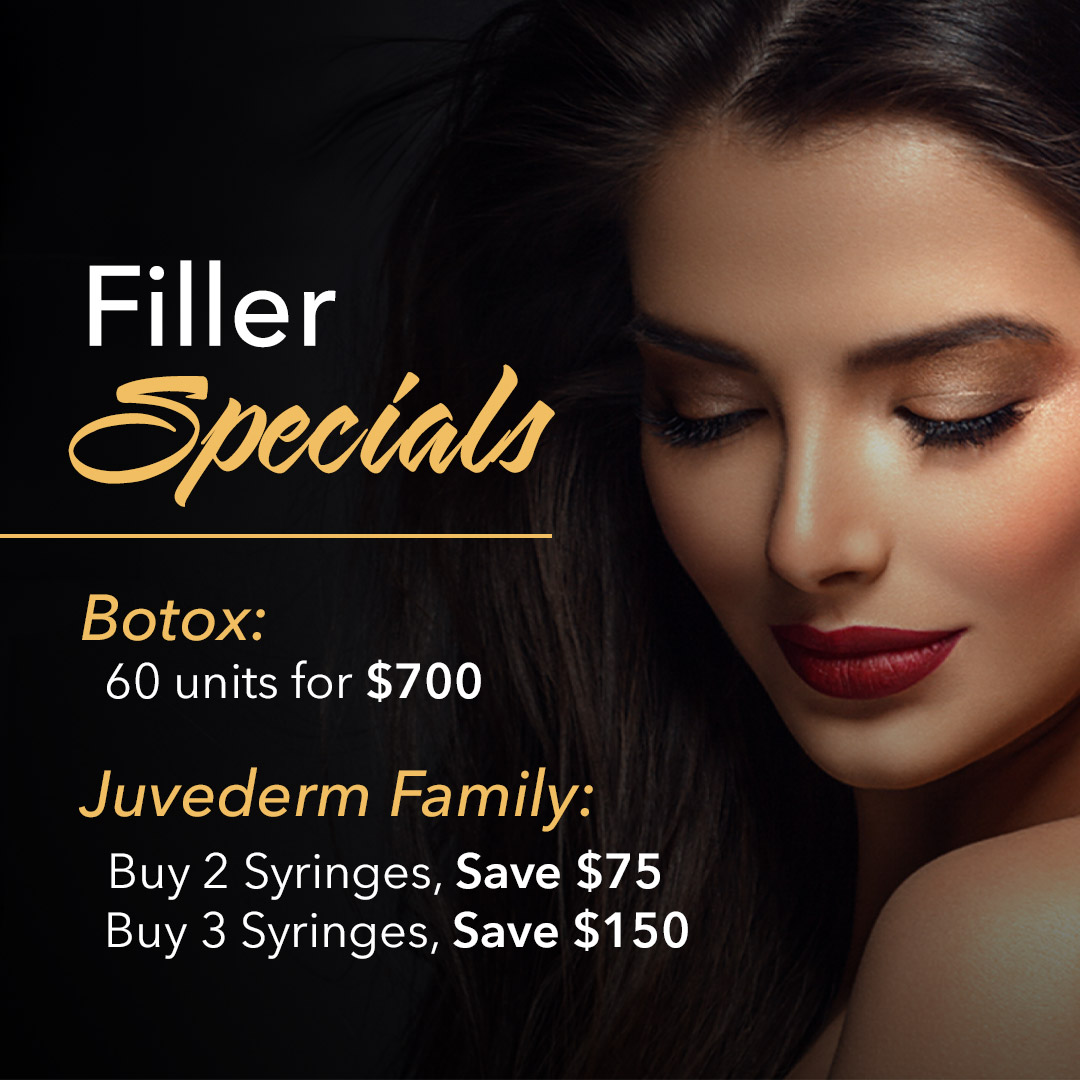 fillers special chicago