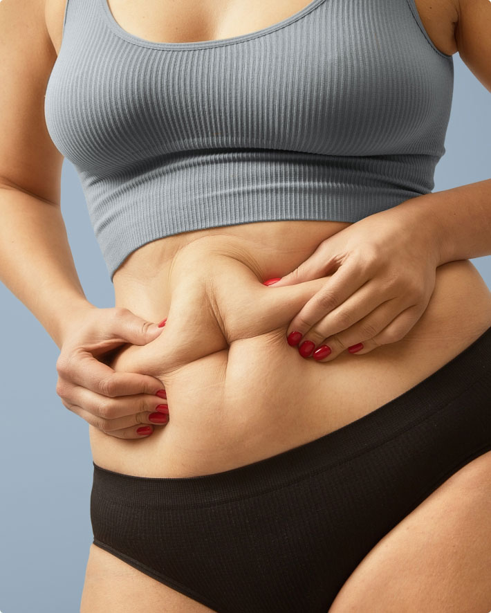 chicago woman squeezing belly fat