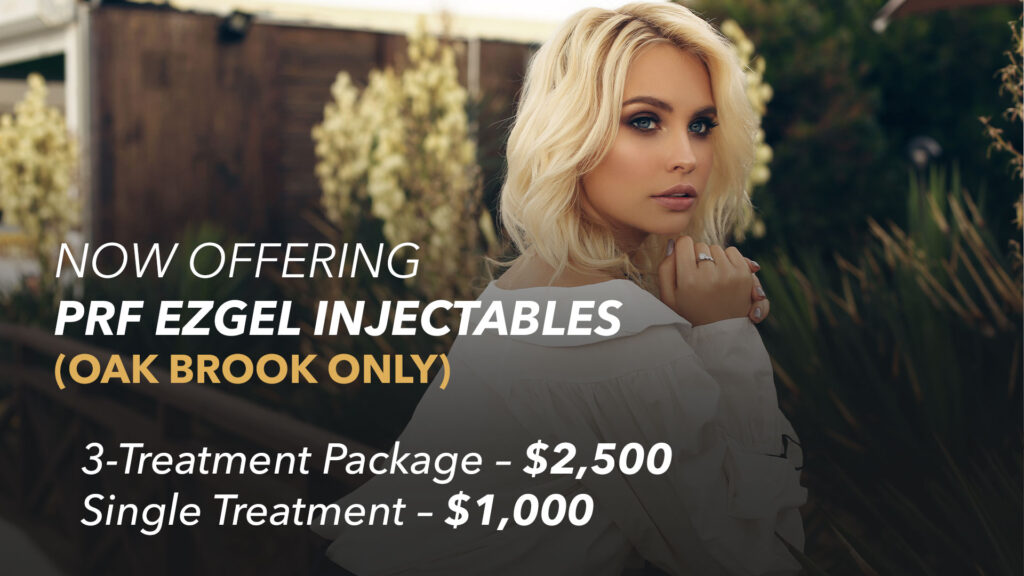 prf specials in chicago july